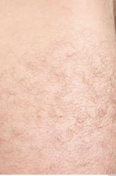 Hairy Skins